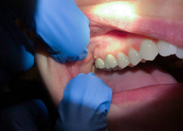 Best Emergency TMJ Treatment in Masury, OH